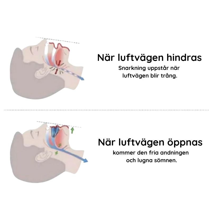 Bett­skena mot snarkning och tandgnissling